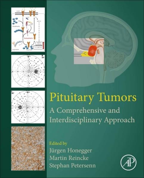 Pituitary Tumors: A Comprehensive and Interdisciplinary Approach - نورولوژی